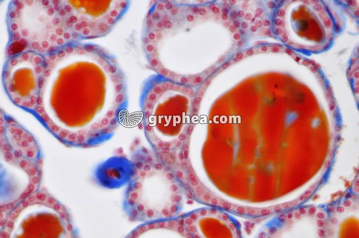 Thyroïde x160 - gryphea.com